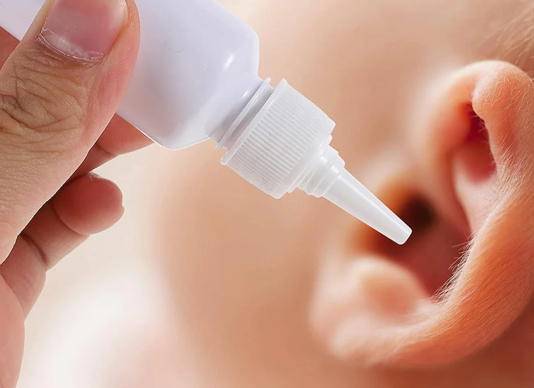 o I Need a Prescription for Acetic Acid Ear Drops? A Complete Guide